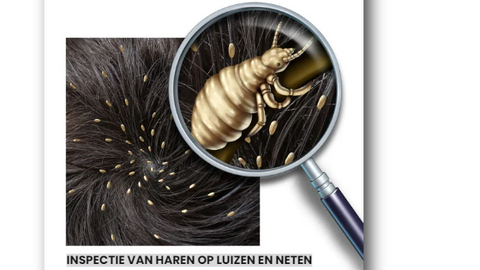 inspectie van haren op luizen en neten met vergrootglas