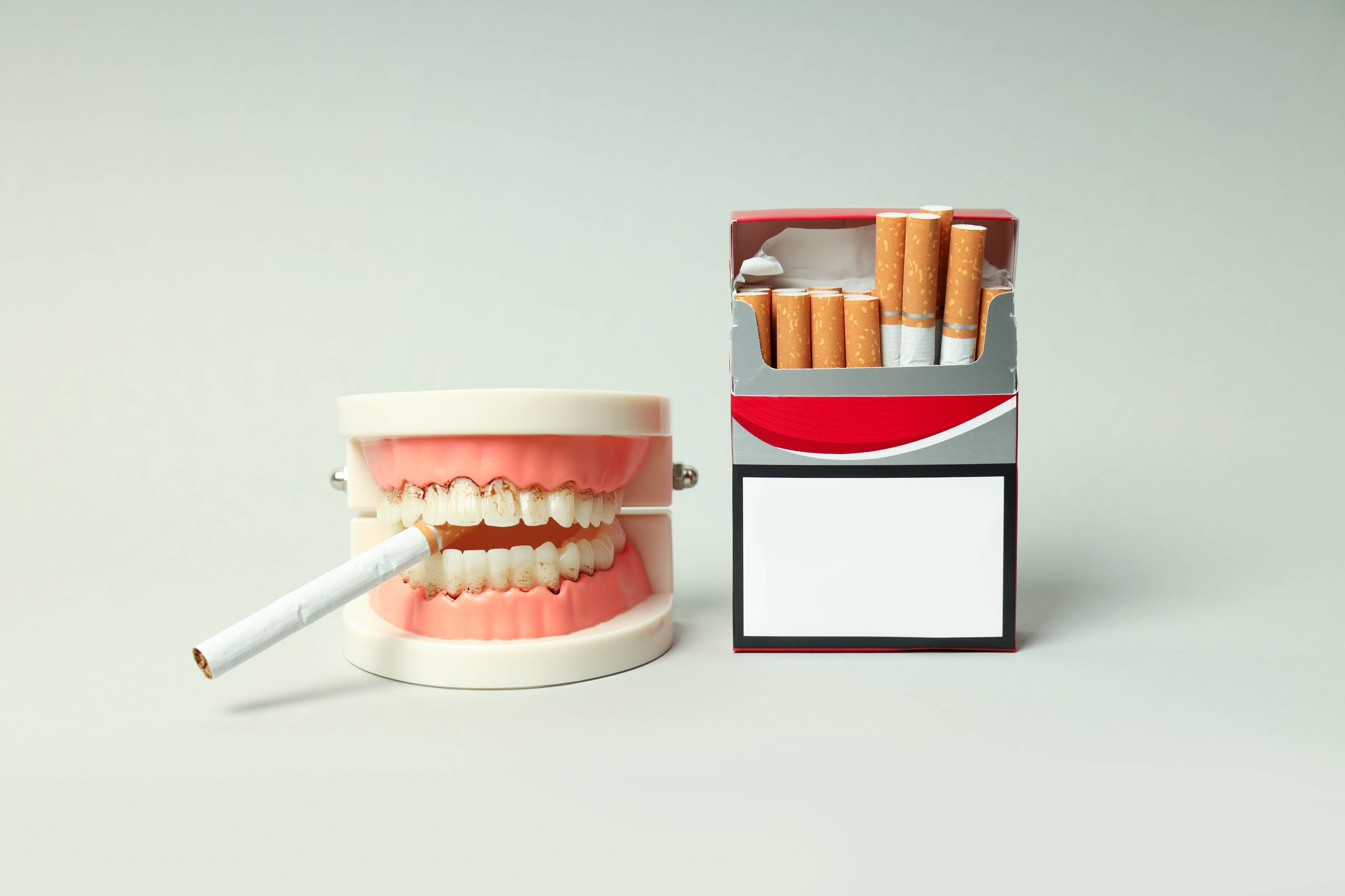 Cigarette abime les dents