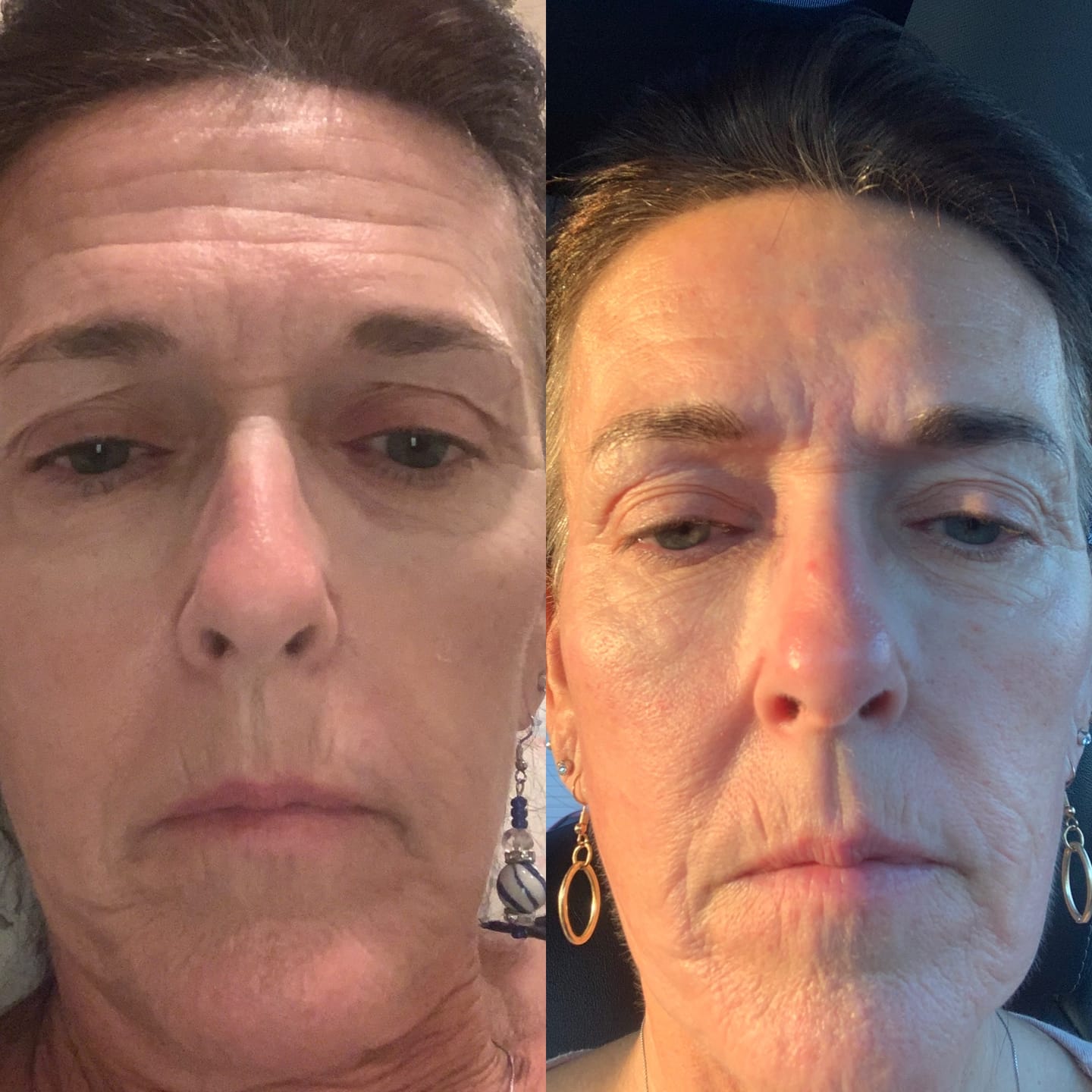 Side-by-side comparison of a person's face showing different lighting or expressions.