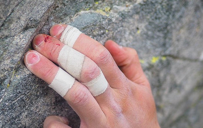 How to Care for Your Climbing Calluses (and prevent flappers) - Just Hand  Stuff