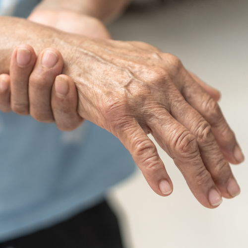 Chemotherapie induzierte Polyneuropathie eine Hand hält die andere fest