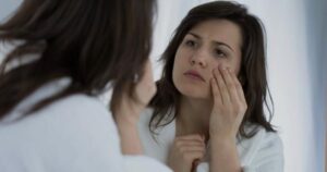 How to Reduce Swelling on Face Home Remedies