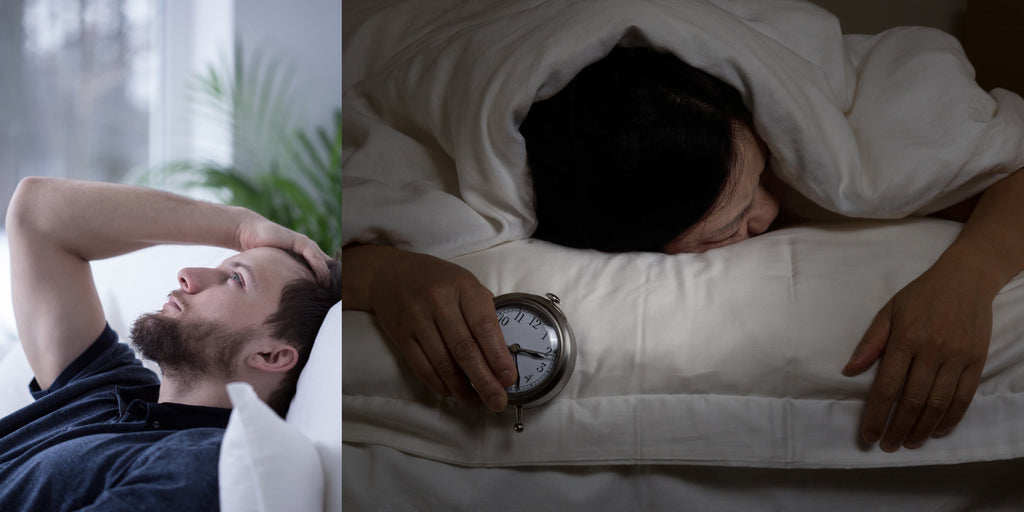 Sleep Deprivation Causes Dark Circles