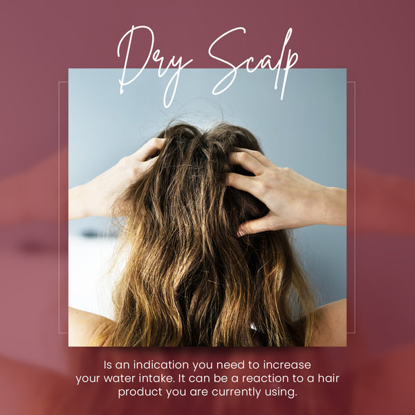 Dry Scalp