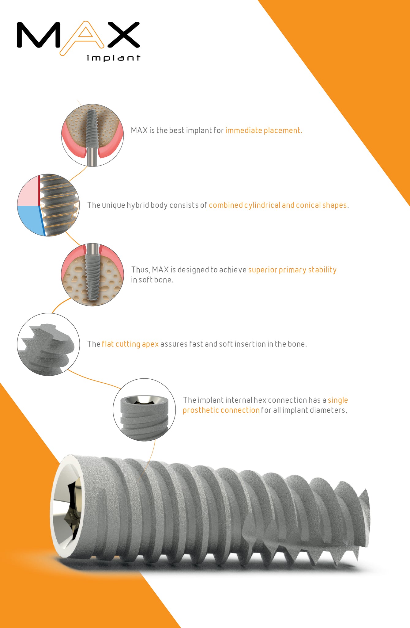 MAX IMPLANT - FLAT CUTTING APEX , Implant featuring an SLA surface, combined cylindrical-conical body, twin-thread design, and apically tapered form. Made of titanium alloy Ti 6Al 4V ELI, with a 2.42mm internal hex screw connection and sandblasted-acid-etched surface. alfa gate dental implants