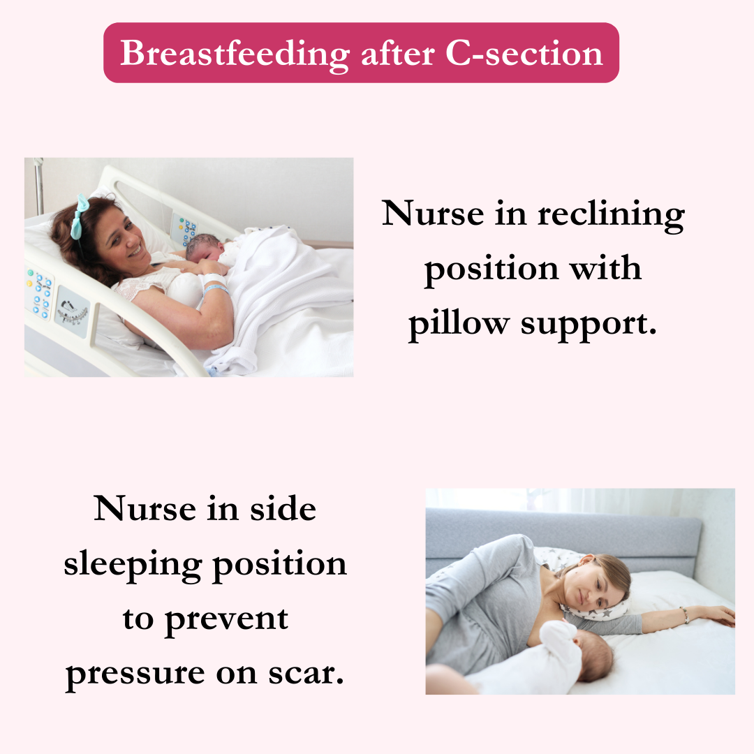 Breastfeeding After a C-Section: Tips & Strategies to Nurse After