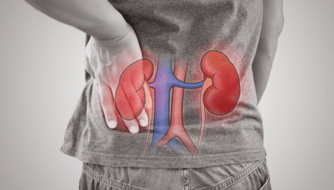 Medical perspectives on kidney stones and gastrointestinal symptoms