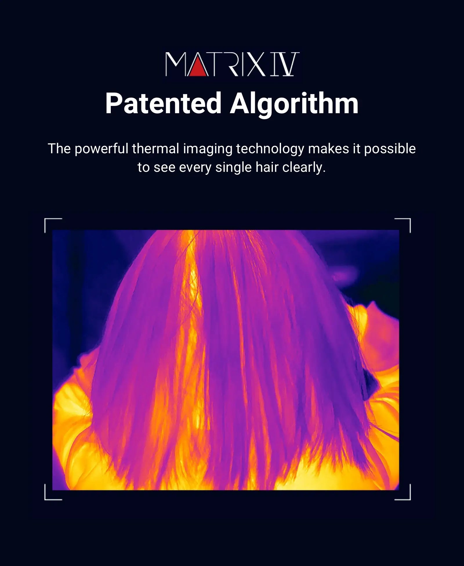 Matrixiv Patented Algorithm