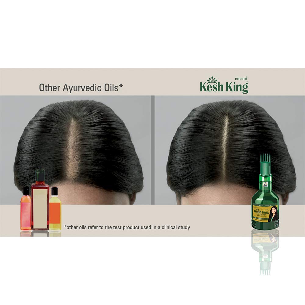 Buy Kesh King Herbal Ayurvedic Hair Oil For Hair Growth 100 Ml   ShopHealthyin