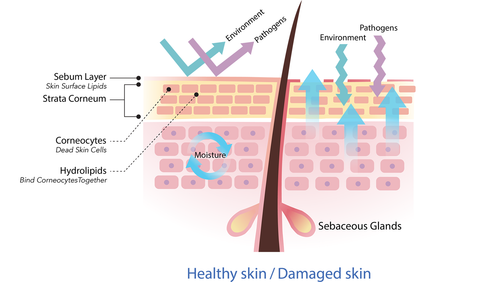 Healthy-Skin-vs-Damaged-Skin-Vector.png__PID:7148e6e6-ac39-40af-b400-ab1914db630a