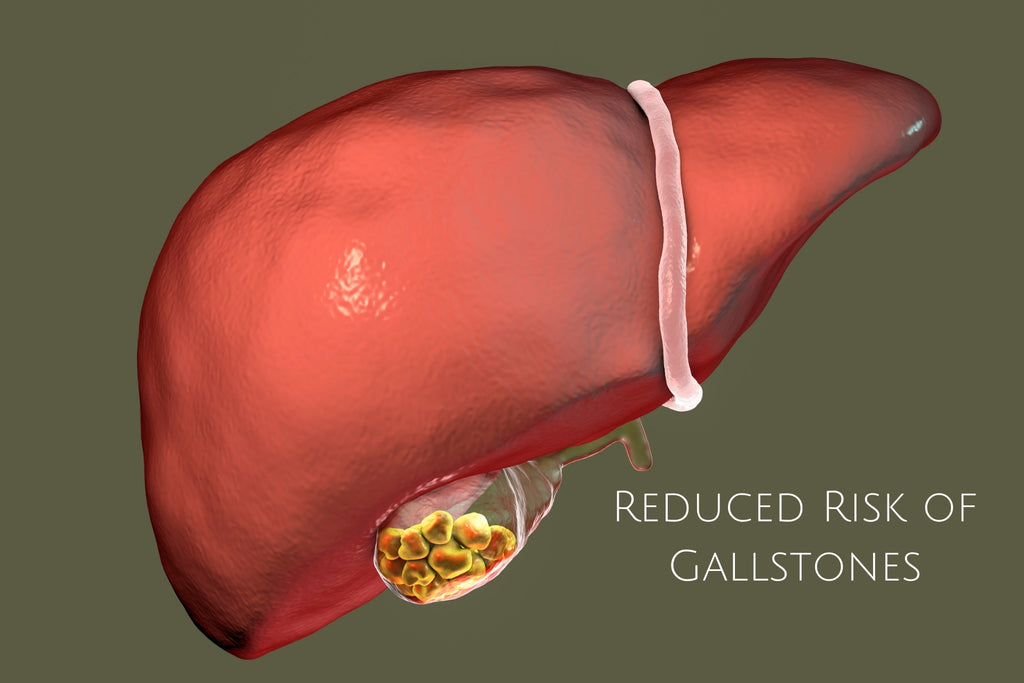 remove risk of gallstones