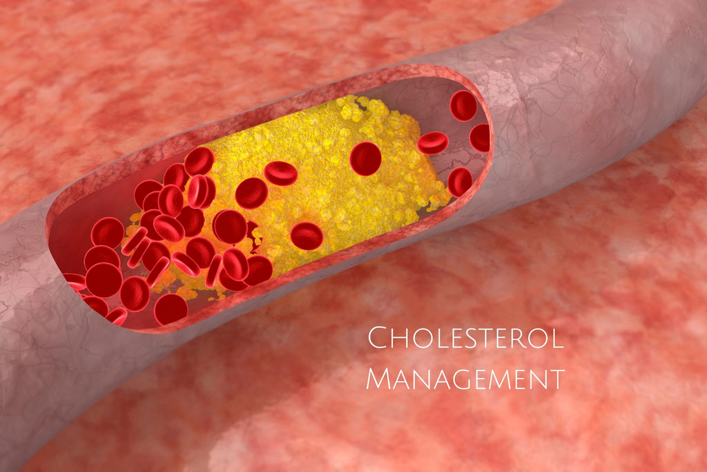 Cholestral Management