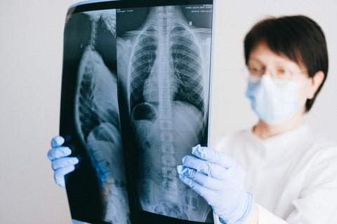 Un médecin examinant une scintigraphie pulmonaire