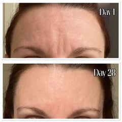 MooGoo Argireline Peptide Serum Results