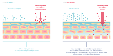 Fonctionnement physiologique de la dermatite atopique