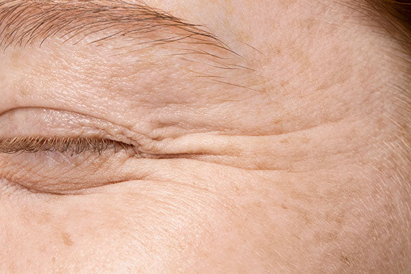 Origin of wrinkles and fine lines