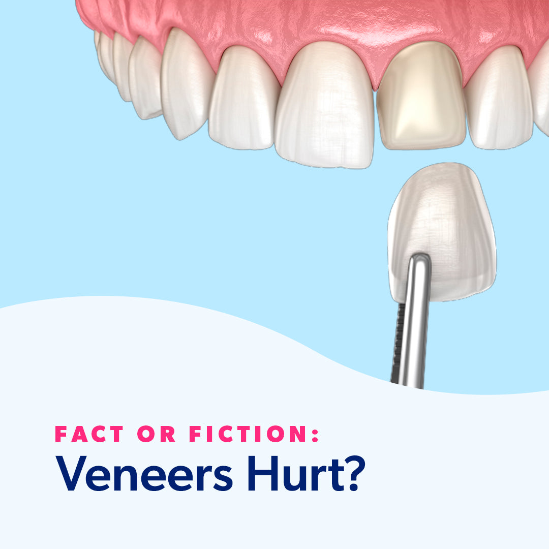 Do Dental Veneers Hurt?