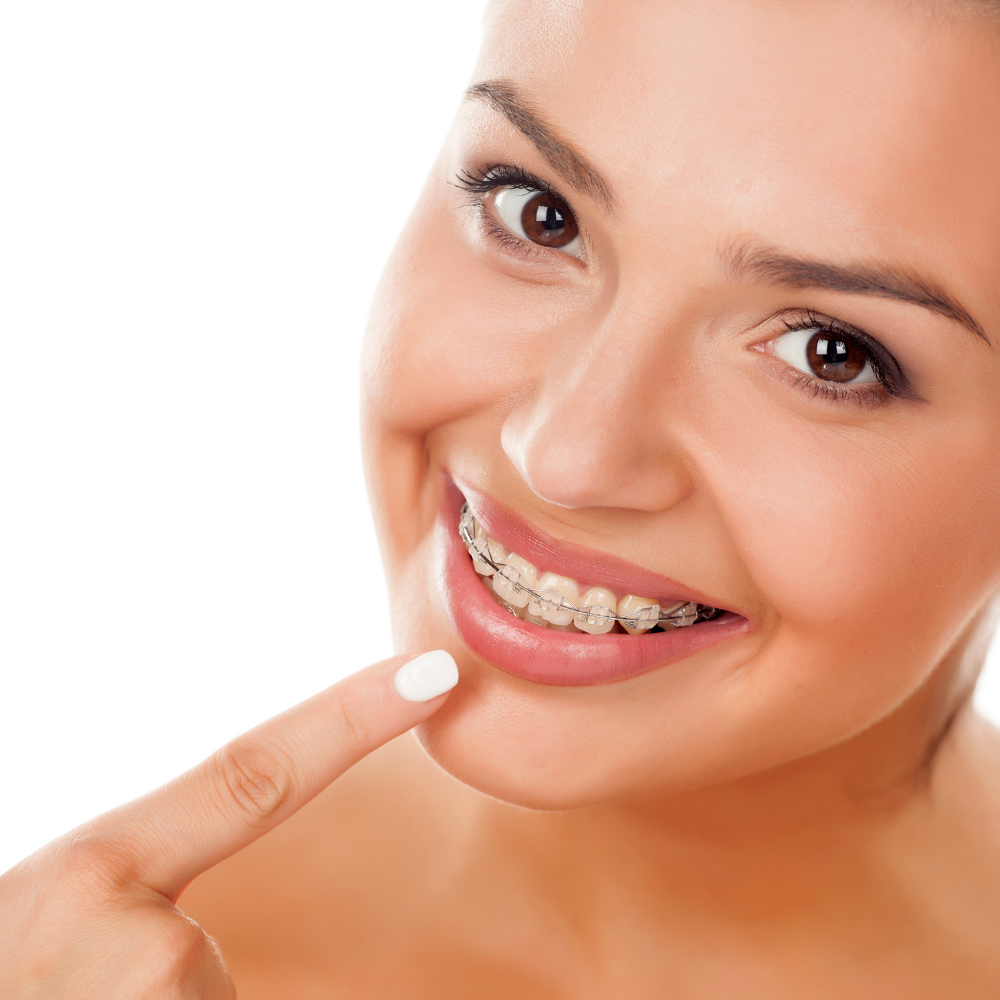 Getting Straighter Teeth doesn't mean Braces