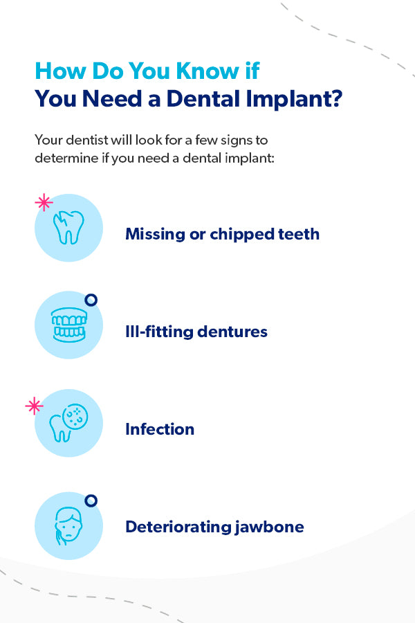 How do you know if you need a dental implant? [list]