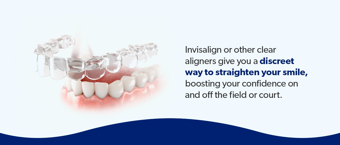 Aligners give you a discreet way to straighten your smile.