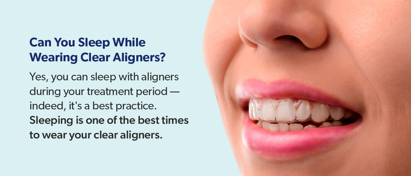 Can you sleep while wearing clear aligners?