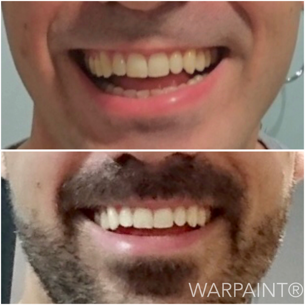 war paint teeth whitening