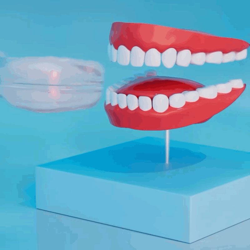férula antirronquidos - Clínica Dental Prodental Híades