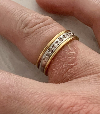 jewellery ring gold reaction allergy