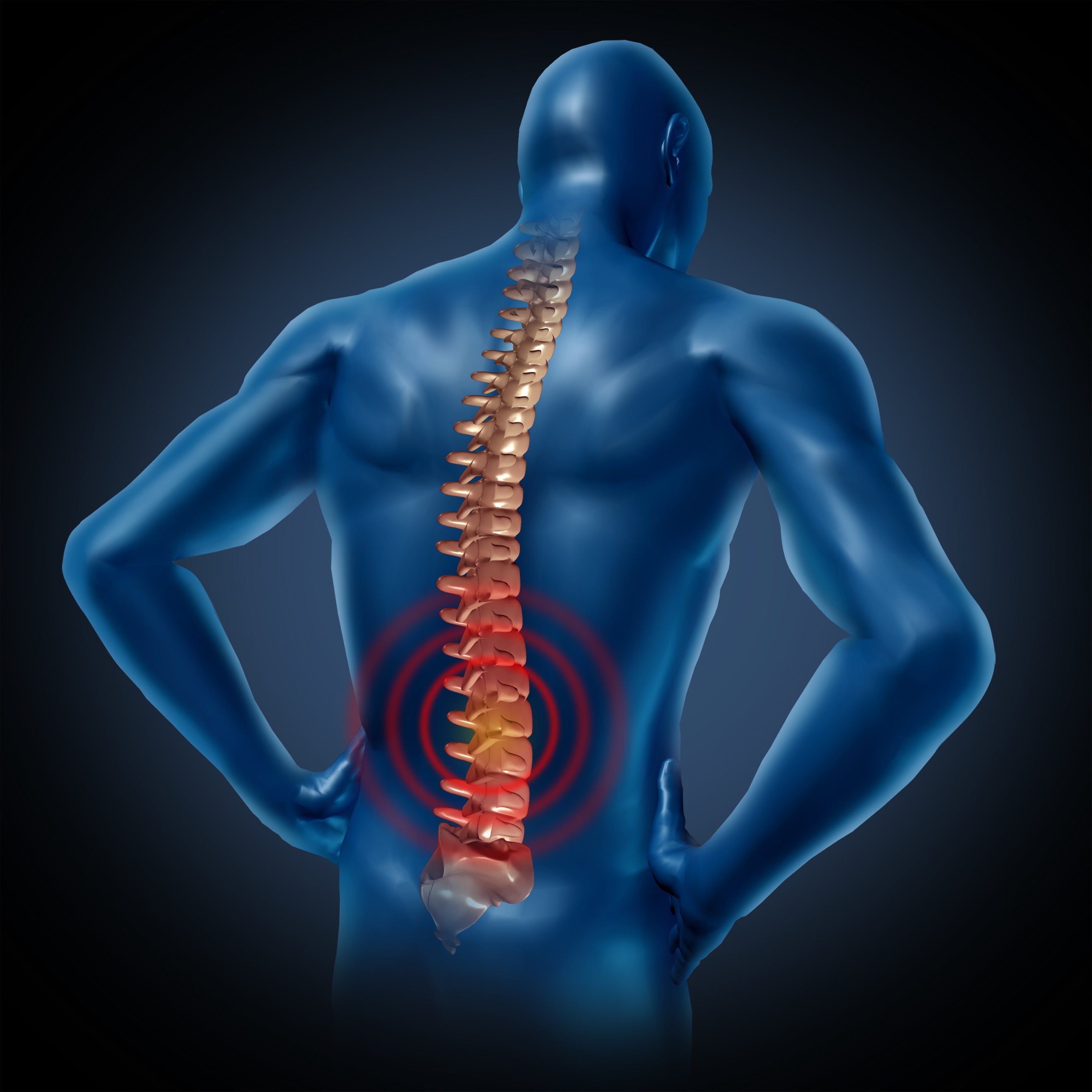 how-to-naturally-prevent-and-reduce-back-pain-power-of-nature