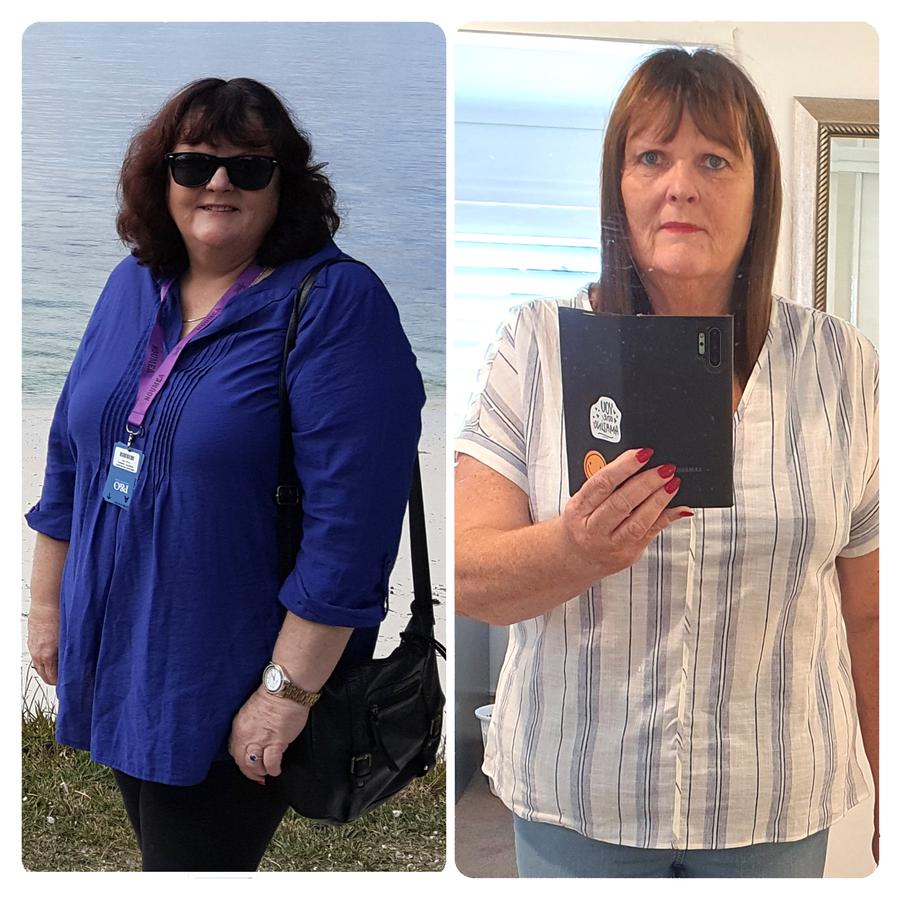 Before and After Transformation Image - BN Healthy