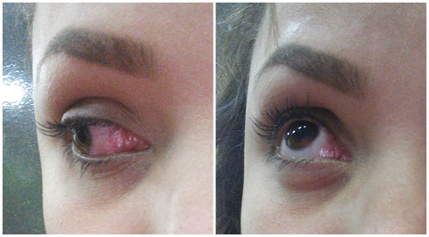 Gotas para ojos con extracto natural para ojos secos Znisnky™