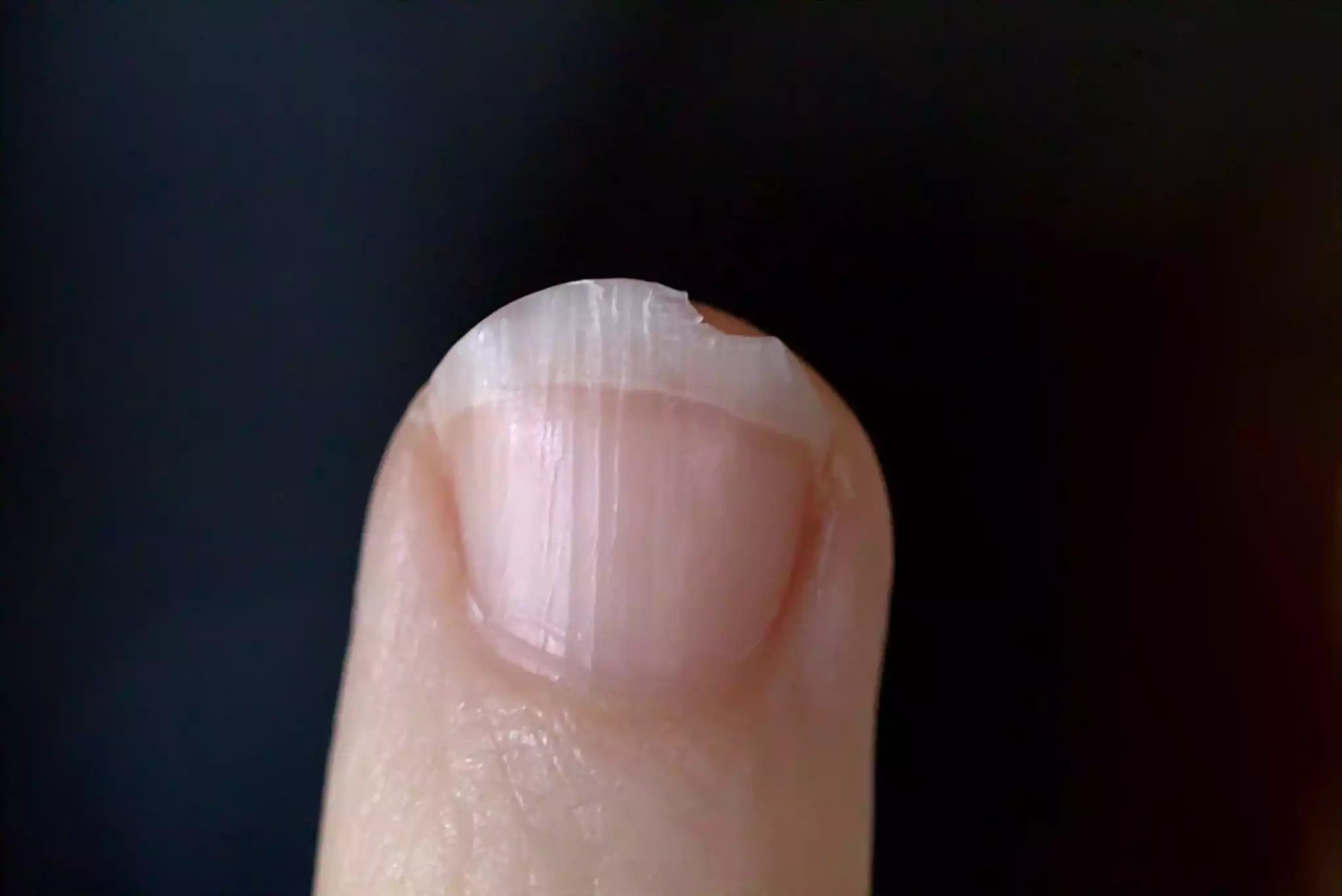 Soigner les ongles cassants, dédoublés, striés et fragilisés : le