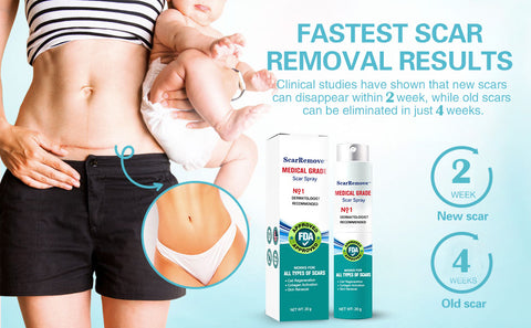 ScarRemove™ Advanced Scar Spray For All Types of Scars - Especially Acne Scars, Surgical Scars and Stretch Marks