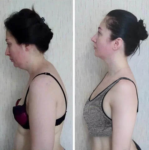 PISPARA Bra, PISPARA Ion Lifting Correction Lymphvity