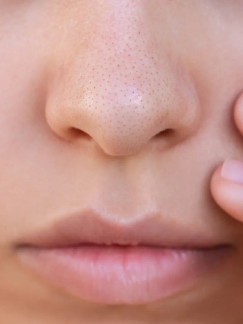 nenän mustapäät läheltä kuvattuna