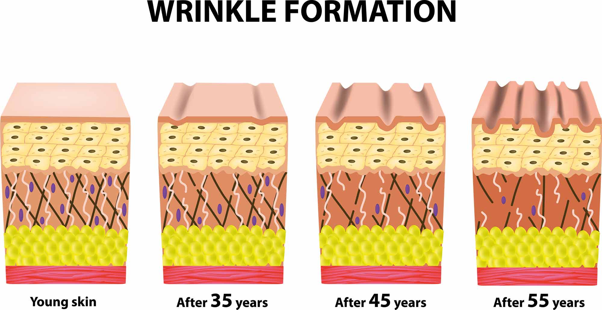 SKin Wrinkle Formation