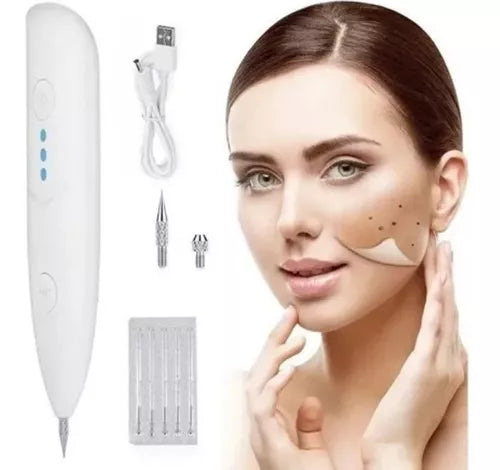 Imagem 1 de Caneta Jato de Plasma Remova Verrugas, Pintas, Tatuagens e Melasma Em Casa