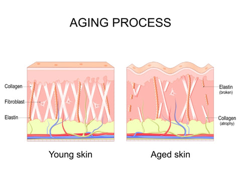 Microneedling