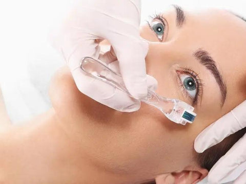 What to Expect Before and After Microneedling
