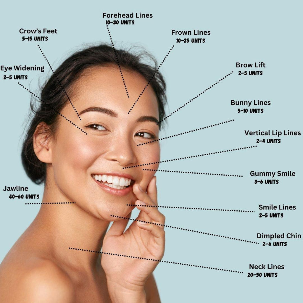 Botox® Treatment dosage guidelines