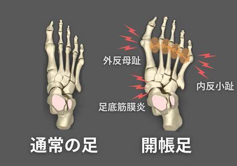 ラクちんソックス　五本指ソックス