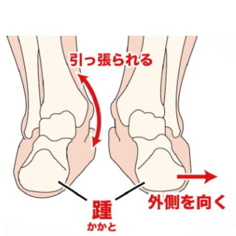 O脚　X脚　しくみ　足首