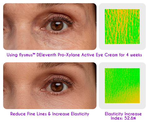 flysmus™ DEleventh Pro-Xylane Active Eye Cream