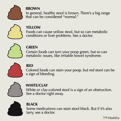 Stool color chart, gut health, gastrointestinal health, microbiome, poop color
