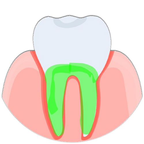 Natto Strengthens tooth's bone density by 35%