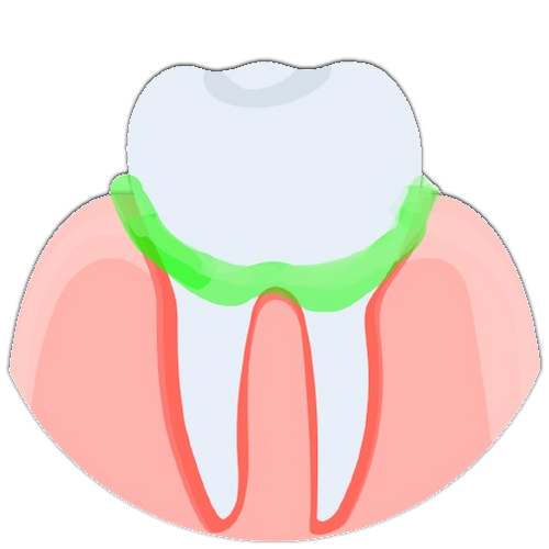 Frankincense Reduces tooth sensitivity by 72%