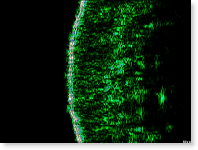 Concentrated Ginseng Renewing Cream EX - Results of Improvement in skin density after 8 weeks of human application test