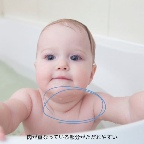 くびの間がただれてしまう赤ちゃん | 洗い方
