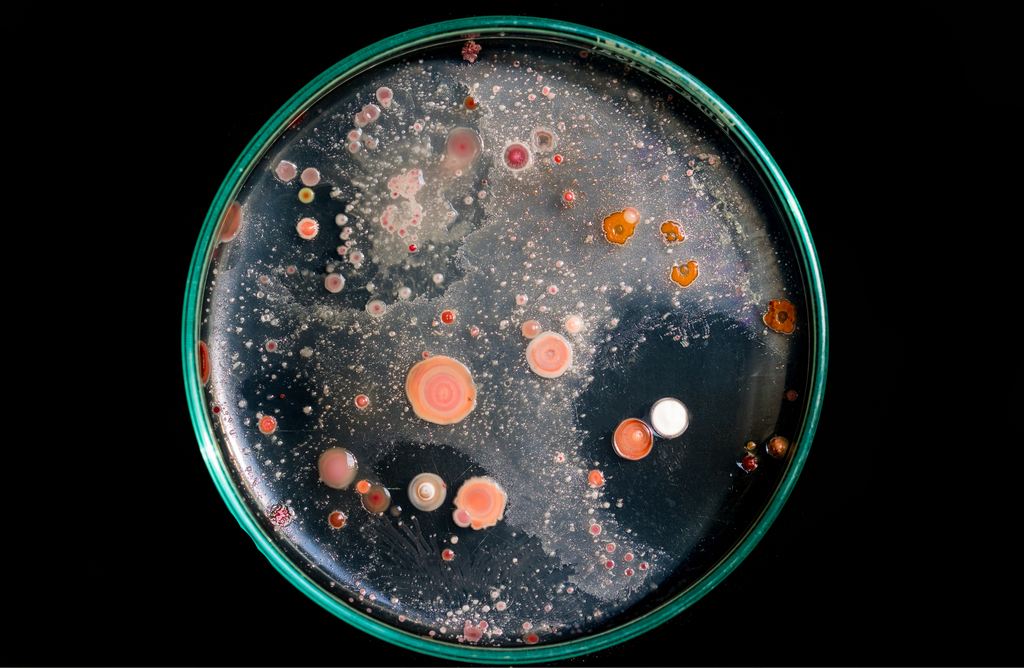 A petri dish with growth used to visualize different microorganisms left on an unsanitized sofa.