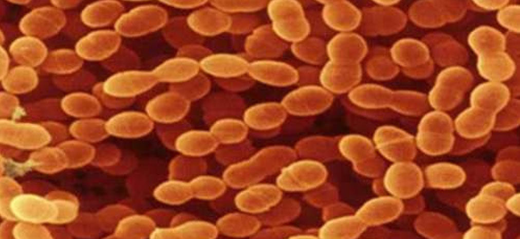 Streptococcus thermophilus